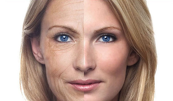 The Signs of Aging Skin